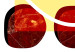 Wall Poster Twelve Steaks - unique abstraction in red circles on a yellow background 117397 additionalThumb 8